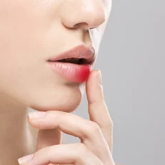 DO YOU OFTEN SUFFER FROM RECURRENT HERPES SIMPLEX OR HERPES ZOSTER? DO YOU OFTEN SUFFER FROM RECURRENT HERPES SIMPLEX OR HERPES ZOSTER?